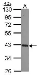 Anti-PCBP2 antibody [N1C1] used in Western Blot (WB). GTX114616