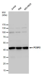 Anti-PCBP2 antibody used in Western Blot (WB). GTX114617