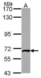 Anti-PGM3 antibody [N1C1] used in Western Blot (WB). GTX114634