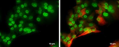Anti-Brn2 antibody used in Immunocytochemistry/ Immunofluorescence (ICC/IF). GTX114650