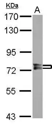 Anti-PPEF1 antibody used in Western Blot (WB). GTX114652