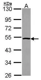 Anti-PSMC4 antibody used in Western Blot (WB). GTX114675