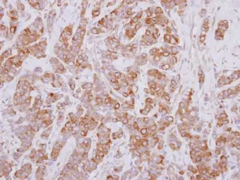 Anti-PSMD5 antibody [N1C1] used in IHC (Paraffin sections) (IHC-P). GTX114681