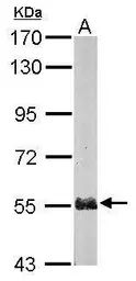 Anti-PSMD5 antibody [N1C1] used in Western Blot (WB). GTX114681