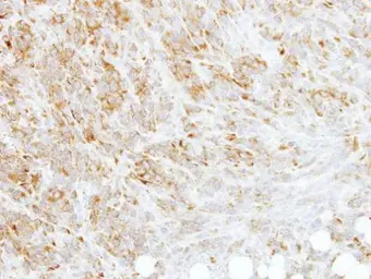 Anti-RPL3 antibody [N3C3] used in IHC (Paraffin sections) (IHC-P). GTX114725