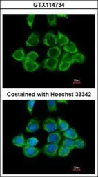 Anti-RPS2 antibody [N2C3] used in Immunocytochemistry/ Immunofluorescence (ICC/IF). GTX114734