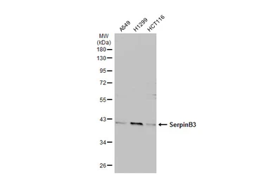 Anti-SerpinB3 antibody [N2C3] used in Western Blot (WB). GTX114739