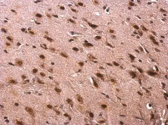 Anti-TRA2B antibody used in IHC (Paraffin sections) (IHC-P). GTX114752
