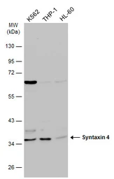 Anti-Syntaxin 4 antibody [N2C3] used in Western Blot (WB). GTX114806