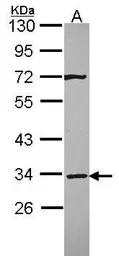Anti-Syntaxin 4 antibody [N2C3] used in Western Blot (WB). GTX114806