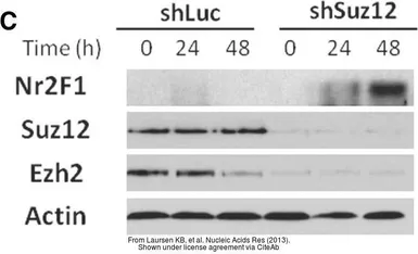 Anti-COUP TF1 antibody [N3C3] used in Western Blot (WB). GTX114835