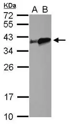 Anti-Tropomyosin 4 antibody used in Western Blot (WB). GTX114851