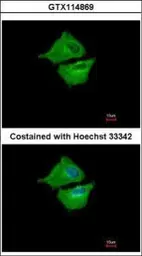 Anti-UBE2G1 antibody used in Immunocytochemistry/ Immunofluorescence (ICC/IF). GTX114869