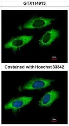 Anti-RPL6 antibody used in Immunocytochemistry/ Immunofluorescence (ICC/IF). GTX114913