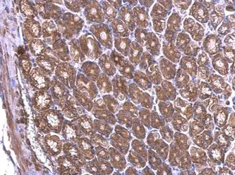 Anti-RPL6 antibody used in IHC (Paraffin sections) (IHC-P). GTX114913