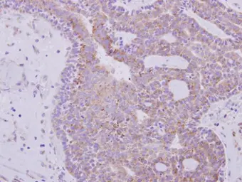 Anti-RPL6 antibody used in IHC (Paraffin sections) (IHC-P). GTX114913