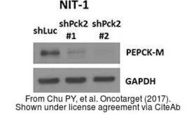 Anti-PCK2 antibody used in Western Blot (WB). GTX114919