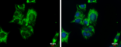 Anti-PCK2 antibody used in Immunocytochemistry/ Immunofluorescence (ICC/IF). GTX114919