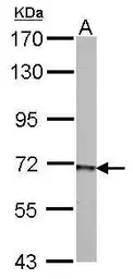 Anti-PCK2 antibody used in Western Blot (WB). GTX114919