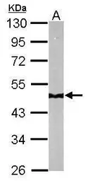 Anti-NDUFS2 antibody used in Western Blot (WB). GTX114924