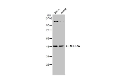 Anti-NDUFS2 antibody used in Western Blot (WB). GTX114924