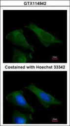 Anti-TIMP4 antibody [N1C3] used in Immunocytochemistry/ Immunofluorescence (ICC/IF). GTX114942
