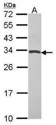 Anti-TIMP4 antibody [N1C3] used in Western Blot (WB). GTX114942