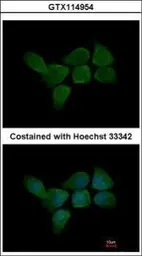Anti-CALML3 antibody [N1C3] used in Immunocytochemistry/ Immunofluorescence (ICC/IF). GTX114954