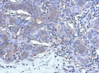 Anti-CALML3 antibody [N1C3] used in IHC (Paraffin sections) (IHC-P). GTX114954
