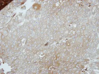 Anti-LIMS1 antibody [N1C2] used in IHC (Paraffin sections) (IHC-P). GTX114984