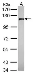 Anti-CNOT3 antibody [C2C3], C-term used in Western Blot (WB). GTX115005