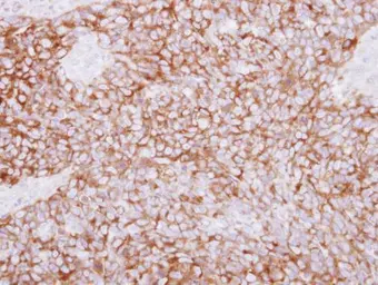 Anti-PLCD1 antibody [C1C3] used in IHC (Paraffin sections) (IHC-P). GTX115009