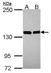 Anti-Valyl tRNA synthetase antibody [N1N2], N-term used in Western Blot (WB). GTX115015
