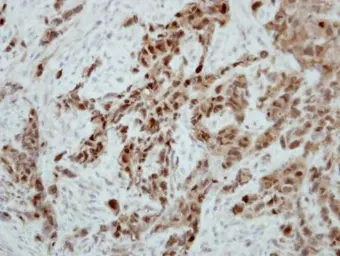 Anti-Ataxin 3 antibody used in IHC (Paraffin sections) (IHC-P). GTX115032