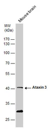 Anti-Ataxin 3 antibody used in Western Blot (WB). GTX115032