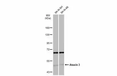 Anti-Ataxin 3 antibody used in Western Blot (WB). GTX115032
