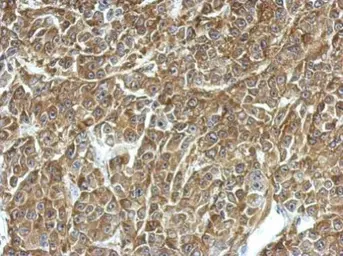 Anti-TPD52 antibody used in IHC (Paraffin sections) (IHC-P). GTX115042