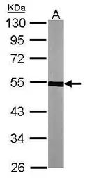 Anti-alpha Tubulin 1A antibody used in Western Blot (WB). GTX115048