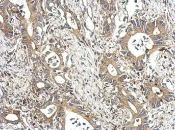 Anti-STAM antibody [N2C2], Internal used in IHC (Paraffin sections) (IHC-P). GTX115060