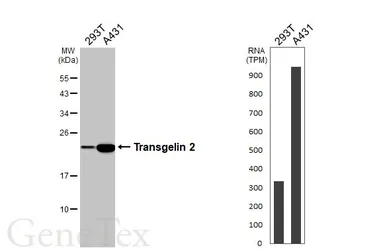 Anti-Transgelin 2 antibody [N1C3] used in Western Blot (WB). GTX115082