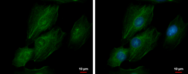 Anti-Transgelin 2 antibody [N1C3] used in Immunocytochemistry/ Immunofluorescence (ICC/IF). GTX115082