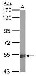 Anti-ALDH1A2 antibody [C1C3] used in Western Blot (WB). GTX115148
