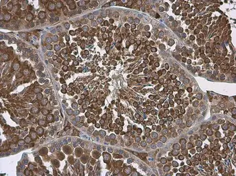 Anti-ALDH1A2 antibody [C1C3] used in IHC (Paraffin sections) (IHC-P). GTX115148