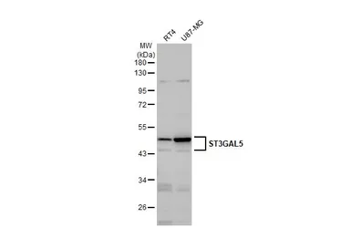 Anti-ST3GAL5 antibody [N3C3] used in Western Blot (WB). GTX115152