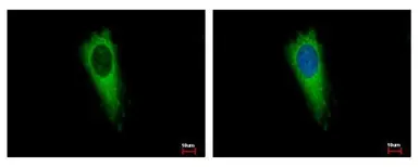 Anti-AIMP1 antibody used in Immunocytochemistry/ Immunofluorescence (ICC/IF). GTX115209