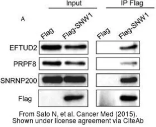 Anti-EFTUD2 antibody [C1C3] used in Western Blot (WB). GTX115222