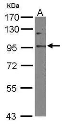 Anti-EFTUD2 antibody [C1C3] used in Western Blot (WB). GTX115222