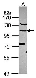 Anti-EFTUD2 antibody [C1C3] used in Western Blot (WB). GTX115222