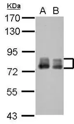 Anti-PLAP antibody [N3C2], Internal used in Western Blot (WB). GTX115226