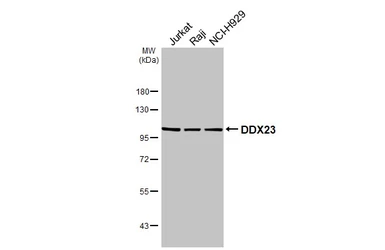 Anti-DDX23 antibody used in Western Blot (WB). GTX115235